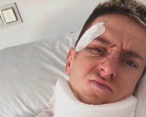 Pogačar se pádu na Vueltě nevyhne operaci. Zářijové mistrovství světa v Montrealu se jej týkat nebude